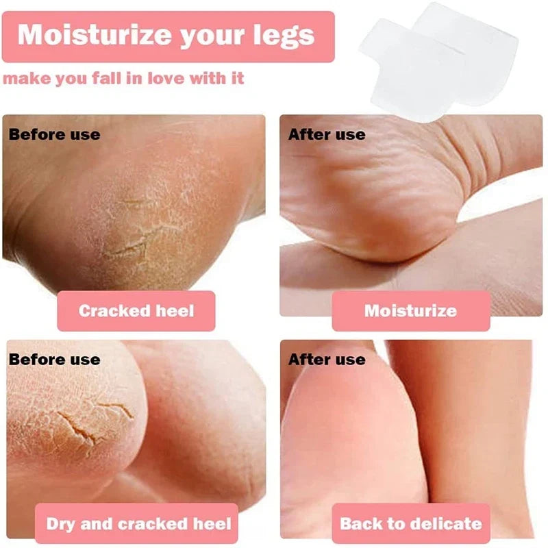 Silicone Heel Cushions and Midfoot Pads – Ultimate comfort for pain-free steps